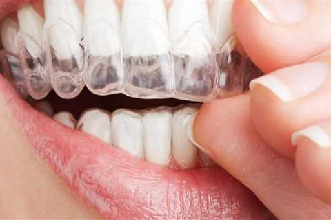 What To Expect When Your Dentist Has A Dental Assistant With Them During Your Invisalign Treatment..