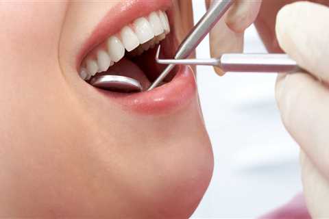 What Types of Dental Supplies are Used for Temporary Fillings?