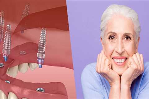 The Benefits of Oral Surgery: A Comprehensive Guide