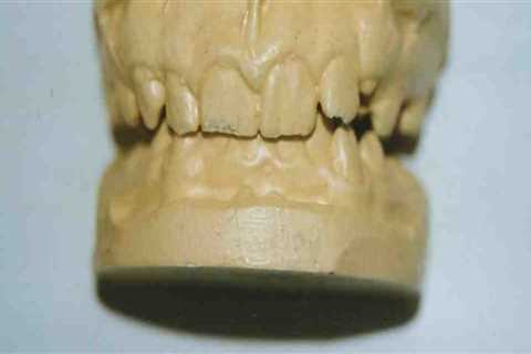 Unveiling the Mysteries of Forensic Odontology in Solving Crimes