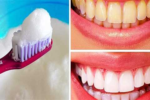 What Really Works to Whiten Teeth at Home? - A Comprehensive Guide