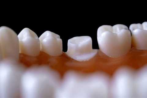 Is a dental crown considered orthodontic?