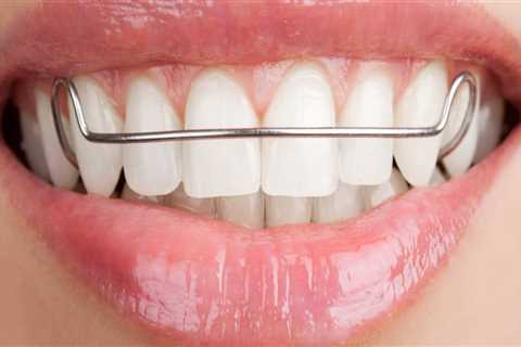 What is a full orthodontic treatment?