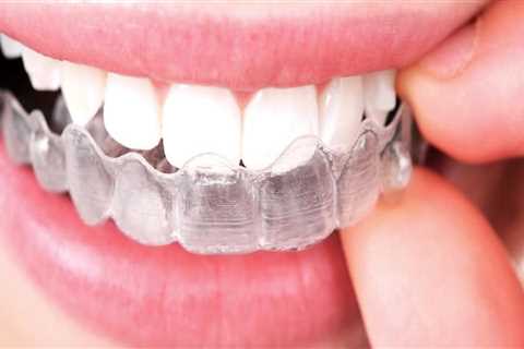 A Patient's Guide To The Role Of Dental Assistants In Invisalign Treatment In Austin