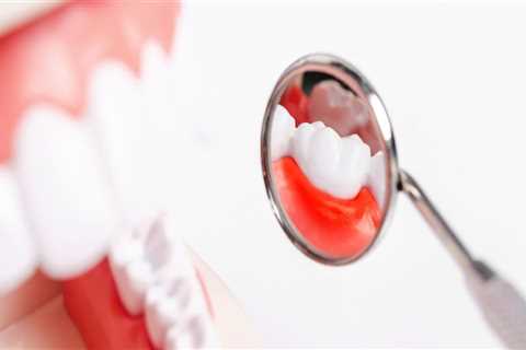 Periodontal Treatments and Procedures: What Do Periodontists Perform?