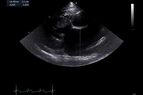 Assessing the Left Atrium in Cats on Focused Cardiac Ultrasound with Dr. Christopher Kennedy |..