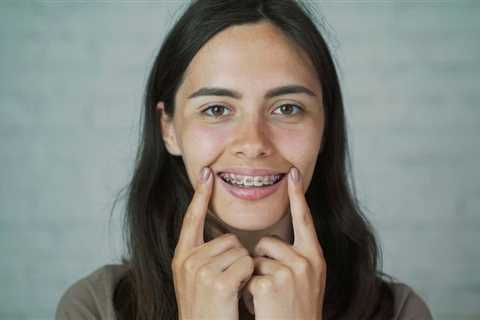 Leveraging Before-and-After Photos in Orthodontic Marketing Campaigns