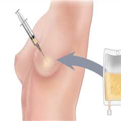 Unlocking Your Body's Potential: How A Health Consultant Can Enhance Your Fat Grafting Experience..