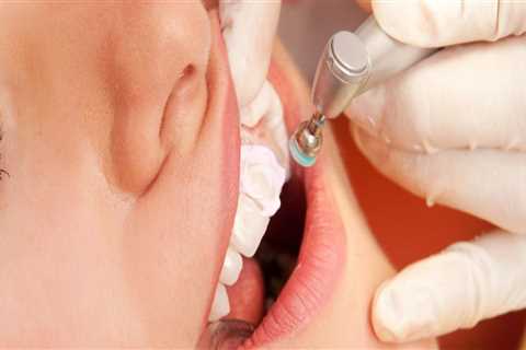 How Dental Hygienists Help Prevent Gum Disease and Tooth Decay