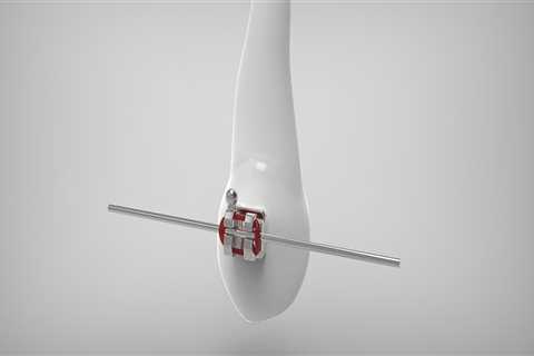 Expert Orthodontics in Alexandria, VA - Hughes Orthodontics